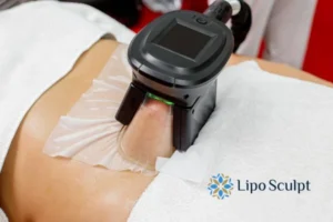 Cryolipolysis Helping You Getting that Perfect Summer Body 3 Cryolipolysis Henley-on-Thames can give you the best summer body - contact us today!