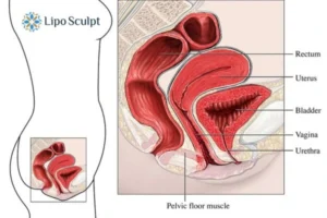 Treatment For A Leaky Bladder 2 How EM Chair treatment Henley-on-Thames can help Leaky bladder issues. Read more now!