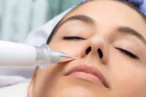 Best Actinic Keratoses Removal 3 Actinic keratoses Henley-on-Thames solutions - book in today!