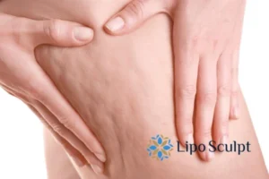 Start your journey today book your coolsculpting treatment Henley-on-Thames online today!